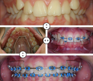 ORTODONTIA 1